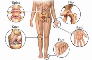 myphysiotherapy reumatologikes pathiseis